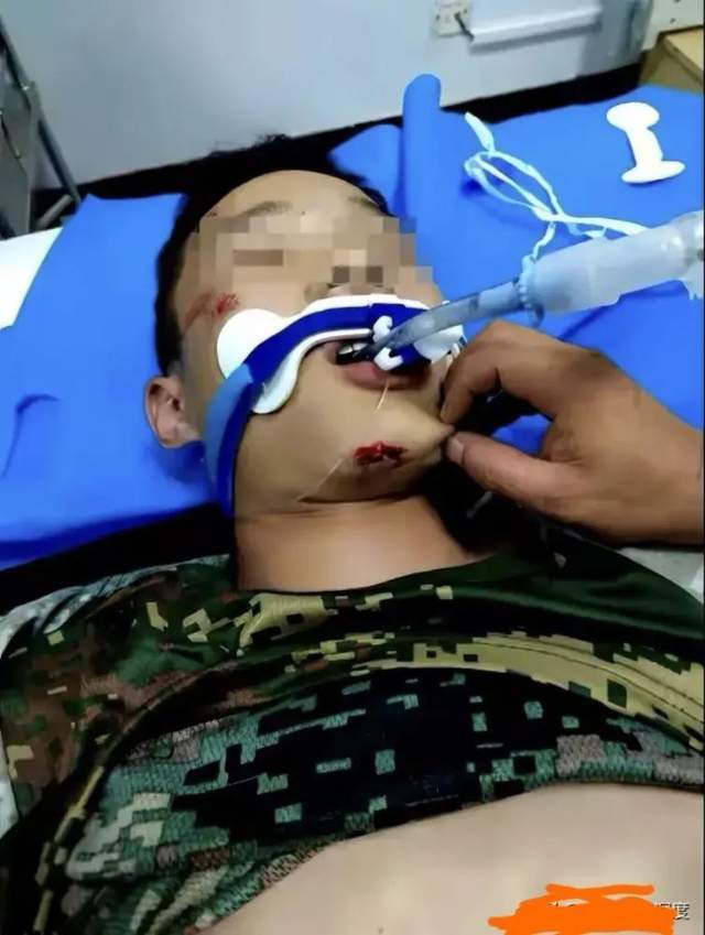 15岁的男孩在学校身体不适，被紧急送往医院后死亡
